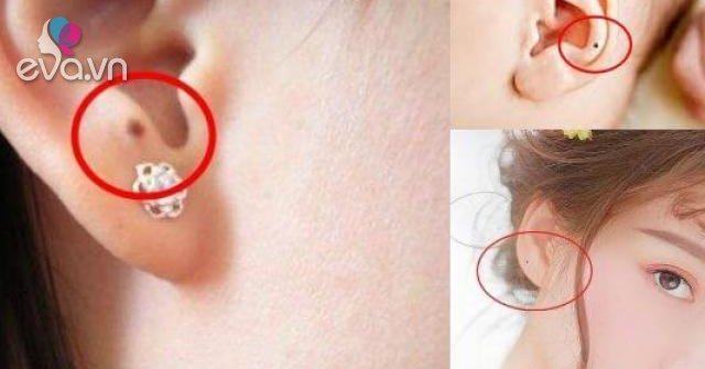 Người may mắn sở hữu 3 nốt ruồi này đích thị đại gia, càng già càng phất