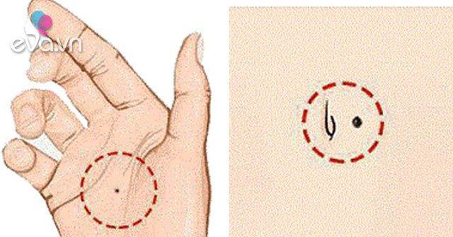 Cơ thể có 5 nốt ruồi này, khó khăn chỉ là tạm thời, phú quý sang giàu là mãi mãi