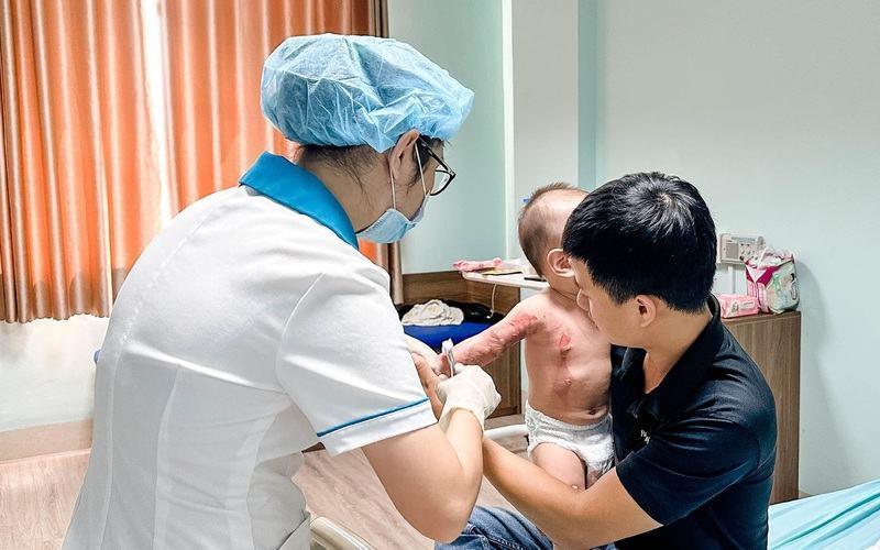 Bé 13 tháng tuổi bị bỏng nước sôi nặng đang được điều trị tại bệnh viện