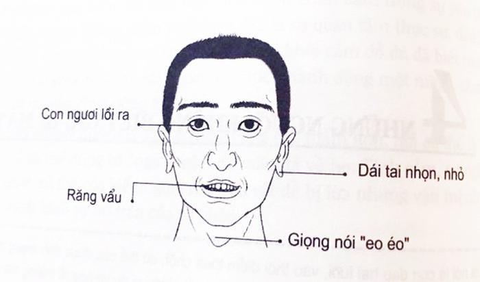 4 nét tướng đàn ông lắm điều nhiều chuyện, dễ gây thị phi khiến ai cũng không ưa