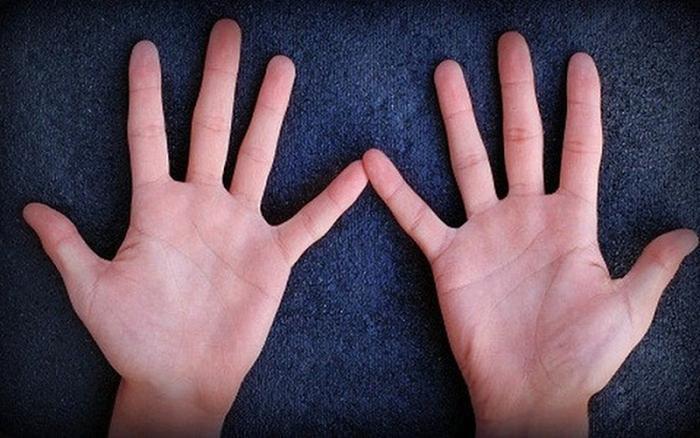 Kẽ Hở Giữa Các Ngón Tay Lớn