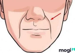 Đường Pháp Lệnh Là Gì? Ý Nghĩa Đường Pháp Lệnh Trên Khuôn Mặt