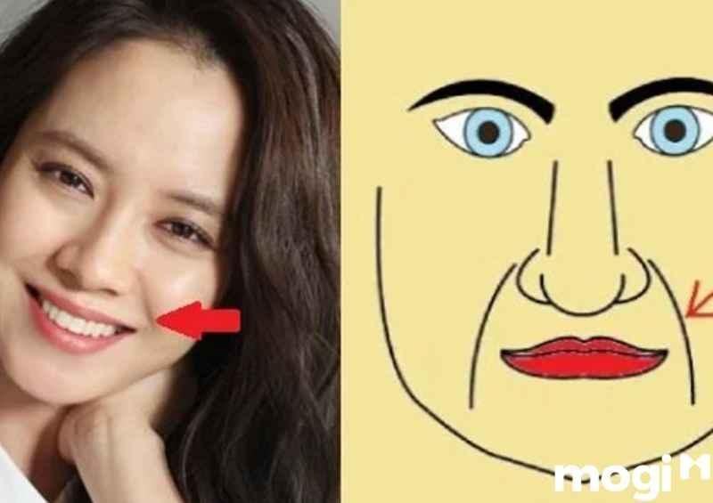 Ý nghĩa đường pháp lệnh bao quanh khóe miệng