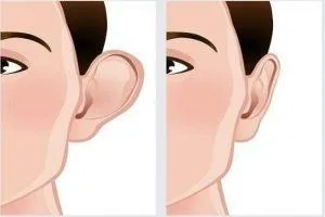 Nét tướng của người khéo ăn nói nhưng dễ bị thị phi đeo bám, kẻ tiêu nhân ghen ghét hãm hại