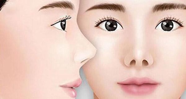 Đặc điểm nhận dạng tướng mũi hếch