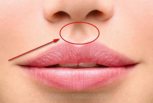 Nhân trung là gì? ở đâu? Ý nghĩa tướng nhân trung nông, sâu, thấp…