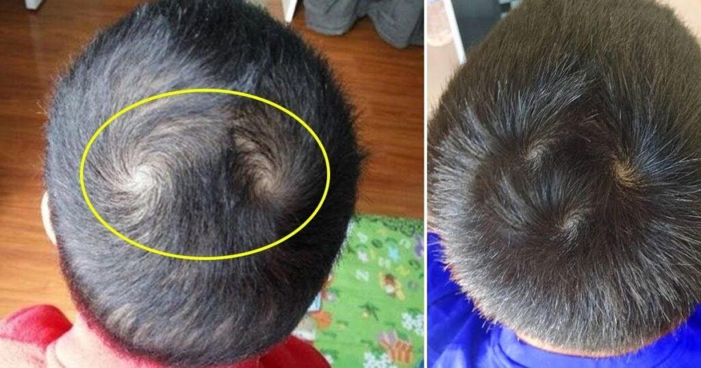 Người có 2 xoáy tóc: Cực kì thông minh, làm nên chuyện lớn, có số giàu có, đào hoa
