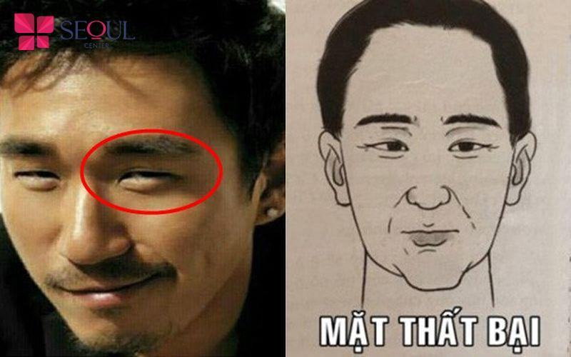 Tướng mũi bần thể hiện người nghèo khổ hay gặp xui xẻo