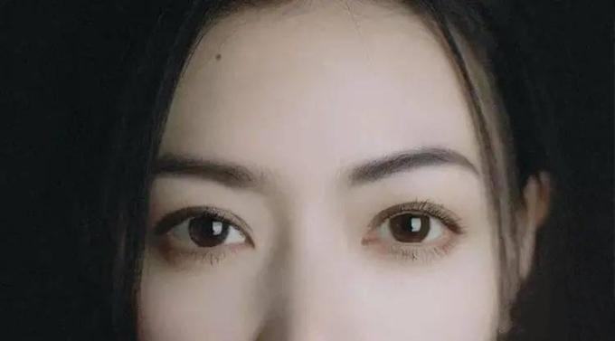 Nốt ruồi ở 4 vị trí này trên mặt ảnh hưởng nhiều đến sự nghiệp mà chẳng mấy người biết, vị trí số 3 hao hụt tài lộc thấy rõ