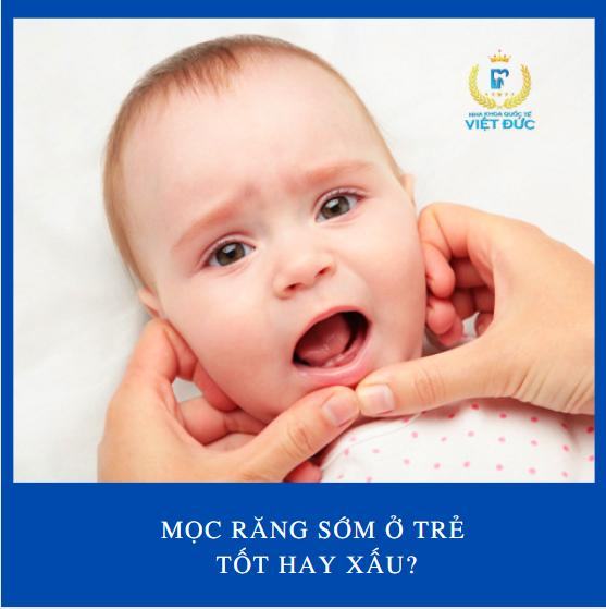 HỆ THỐNG NHA KHOA UY TÍN TẠI VIỆT NAM