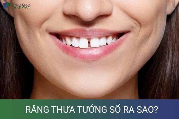 Người Răng Thưa Có Tướng Số Như Thế Nào?
