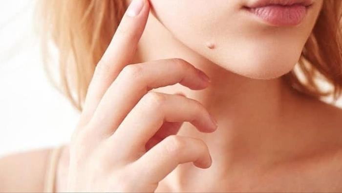 Những nốt ruồi biểu hiện tướng phú quý, cuộc sống càng về hậu vận càng sung túc, giàu có