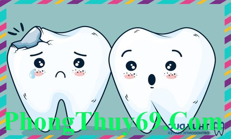 Hình ảnh răng bị mẻ