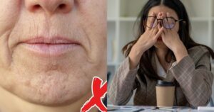 5 Kiểu phụ nữ dễ bị lão hóa Do collagen bị hút cạn