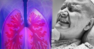Không phải thuốc lá, đây mới là thủ phạm gây ung thư phổi đáng sợ nhất