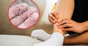 Nghiên cứu mới về vi nhựa trong xương người gây lo ngại