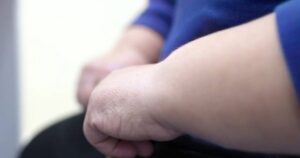 Tăng cân sau hôn nhân: Hành trình giảm 60kg và kiểm soát tâm lý