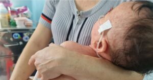 Vì sao bệnh sởi nguy hiểm và diễn tiến nhanh ở trẻ nhỏ
