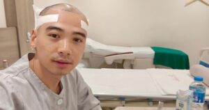 Căn bệnh hói đầu của chồng H ' Hen Niê và những đàn ông khác thường gặp phải