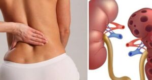 9 Dấu hiệu thận yếu ở phụ nữ cần chú ý để bảo vệ sức khỏe