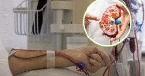 Người trẻ mắc suy thận ngày càng tăng: 3 Lời khuyên bác sĩ giúp dự phòng sớm
