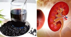 Uống nước đậu đen có tốt cho thận không? tìm hiểu lợi ích sức khỏe