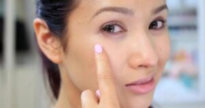 Dấu hiệu thiếu vitamin xuất hiện trên khuôn mặt: Đừng chủ quan với sức khỏe của bạn