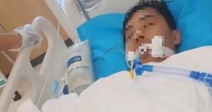 Người đàn ông 60 tuổi tử vong sau khi ăn vịt kho gừng và những cảnh báo sức khỏe