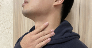 Uống nước ngọt nhiều gây trào ngược dạ dày và hệ lụy sức khỏe nghiêm trọng