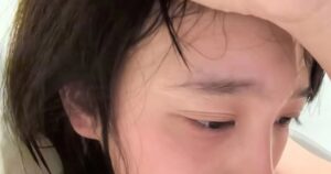 Thấy triệu chứng lạ ở đầu và mặt , khám ngay kẻo ung thư phổi nguy hiểm