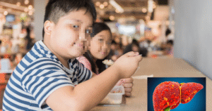 Trẻ 11 - 12 tuổi mắc bệnh mỡ máu và gan nhiễm mỡ: Những nguyên nhân và cách phòng ngừa