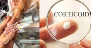 Cảnh báo sức khỏe: Lạm dụng corticoid gây hậu quả nghiêm trọng cho da