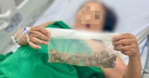 Cụ bà 78 tuổi ở Hà Nội bị sốc tim do củ ấu tầu độc hại mua trên mạng