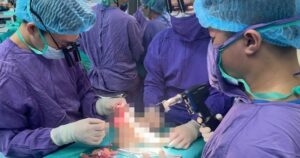 Nối lại chân đứt lìa thành công cho nữ sinh 19 tuổi sau tai nạn mô tô