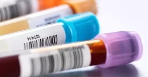 Cảnh báo gia tăng viêm não do Parvovirus B19 ở trẻ em tại Việt Nam