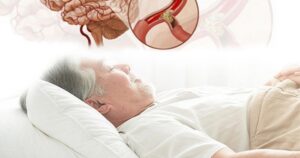 Cảnh báo nguy cơ đột tử do ngủ ngáy kéo dài và hội chứng ngưng thở khi ngủ