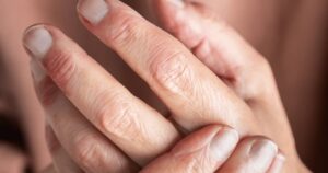 Dấu hiệu tổn thương gan qua tay và chân cần lưu ý để bảo vệ sức khỏe