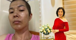 Hành trình vượt qua ung thư giai đoạn 3 của chị Hà: Niềm tin và nghị lực sống