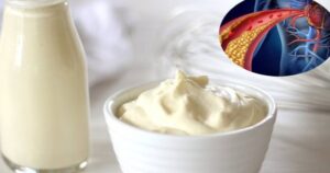 Loại thực phẩm giới trẻ đặc biệt yêu thích nhưng cẩn trọng kẻo gây rối loạn mỡ máu