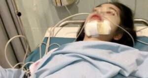 Ngày càng nhiều người chết vì ung thư vòm họng? Bác sĩ cảnh báo: Có 5 nhóm người bị liệt vào danh sách "RỦI RO CAO"