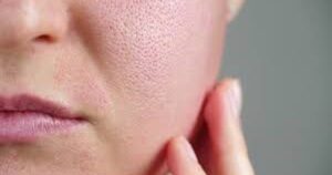 2 Lọai nước gây nếp nhăn sâu mà nhiều chị em không biết ảnh hưởng đến làn da
