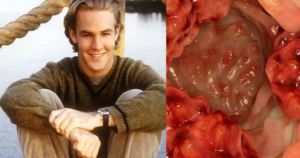 James Van Der Beek qua đời do ung thư đại trực tràng: Bệnh trẻ hóa đáng báo động 2026