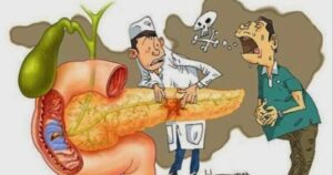 Tăng vọt ca viêm tụy cấp sau Tết 2026: Nguy cơ và cách phòng tránh hiệu quả