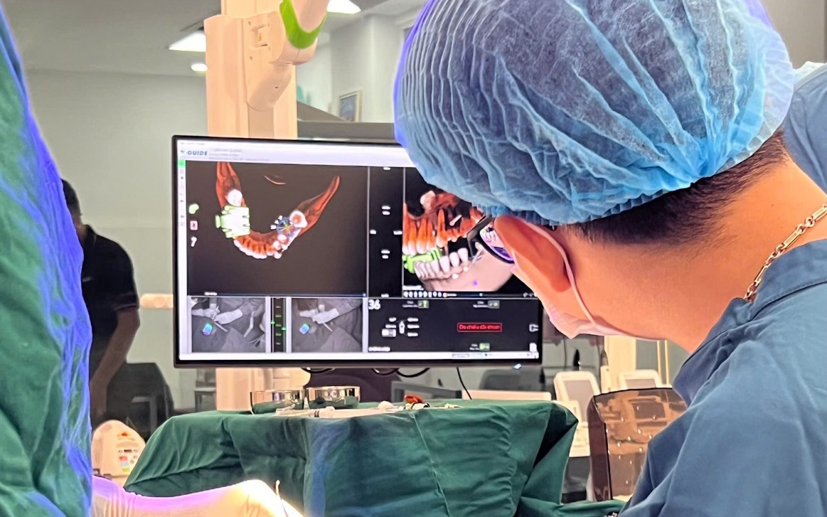 3 Yếu tố quan trọng giúp cấy ghép Implant thành công và bền vững năm 2026 - Nha Khoa Như Ngọc