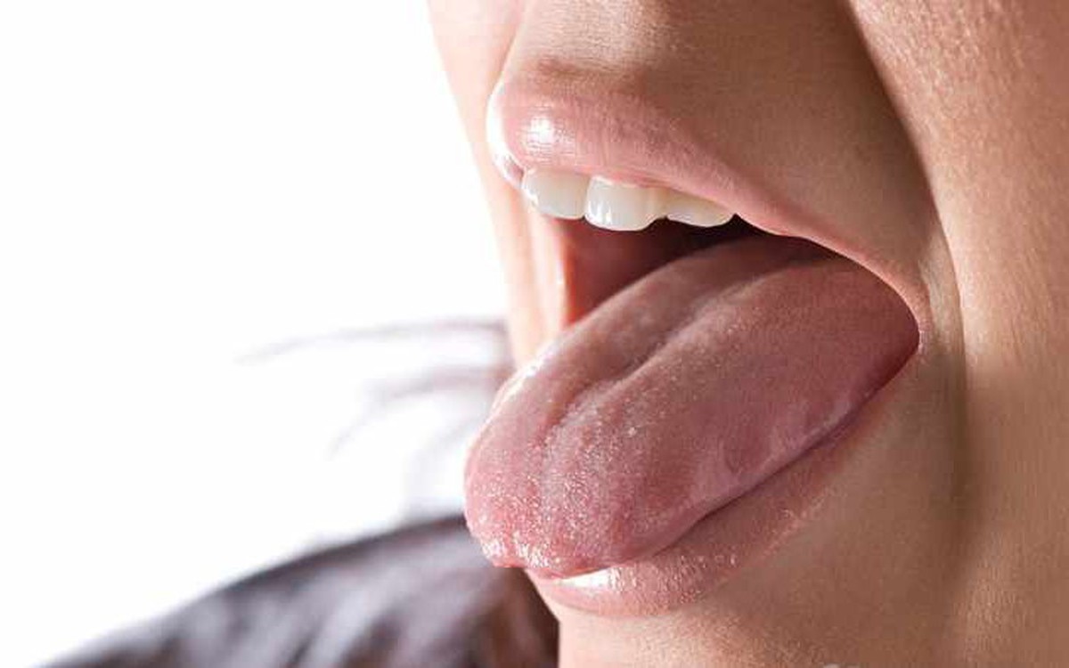 Cảnh giác với ung thư lưỡi: Câu chuyện cảnh tỉnh Từ người đàn ông 41 tuổi