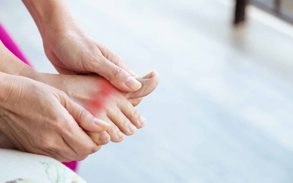 Chế độ ăn cho người bệnh Gout: 4 Thực phẩm hạ axit uric hiệu quả năm 2026