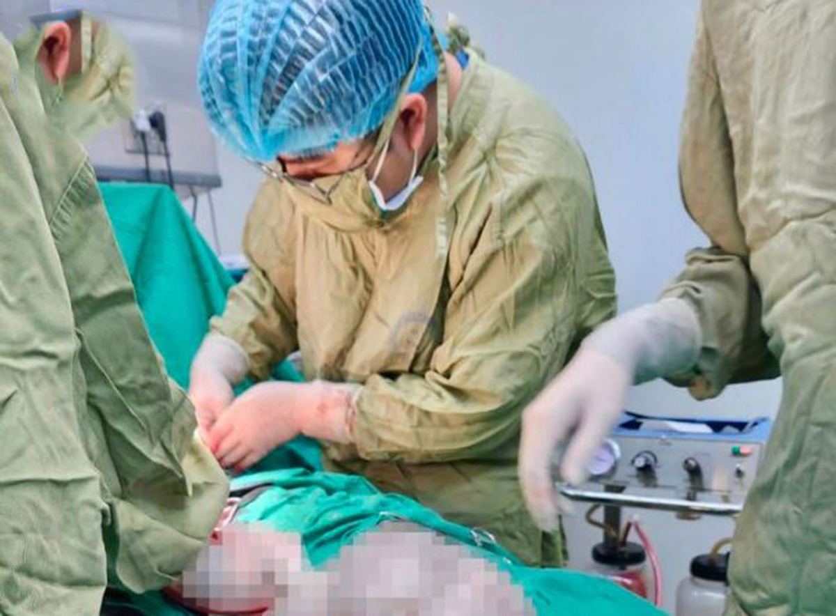 Thiếu nữ 14 tuổi mang u 4,3kg chứa tóc và răng, gia đình lại nghĩ con tăng cân
