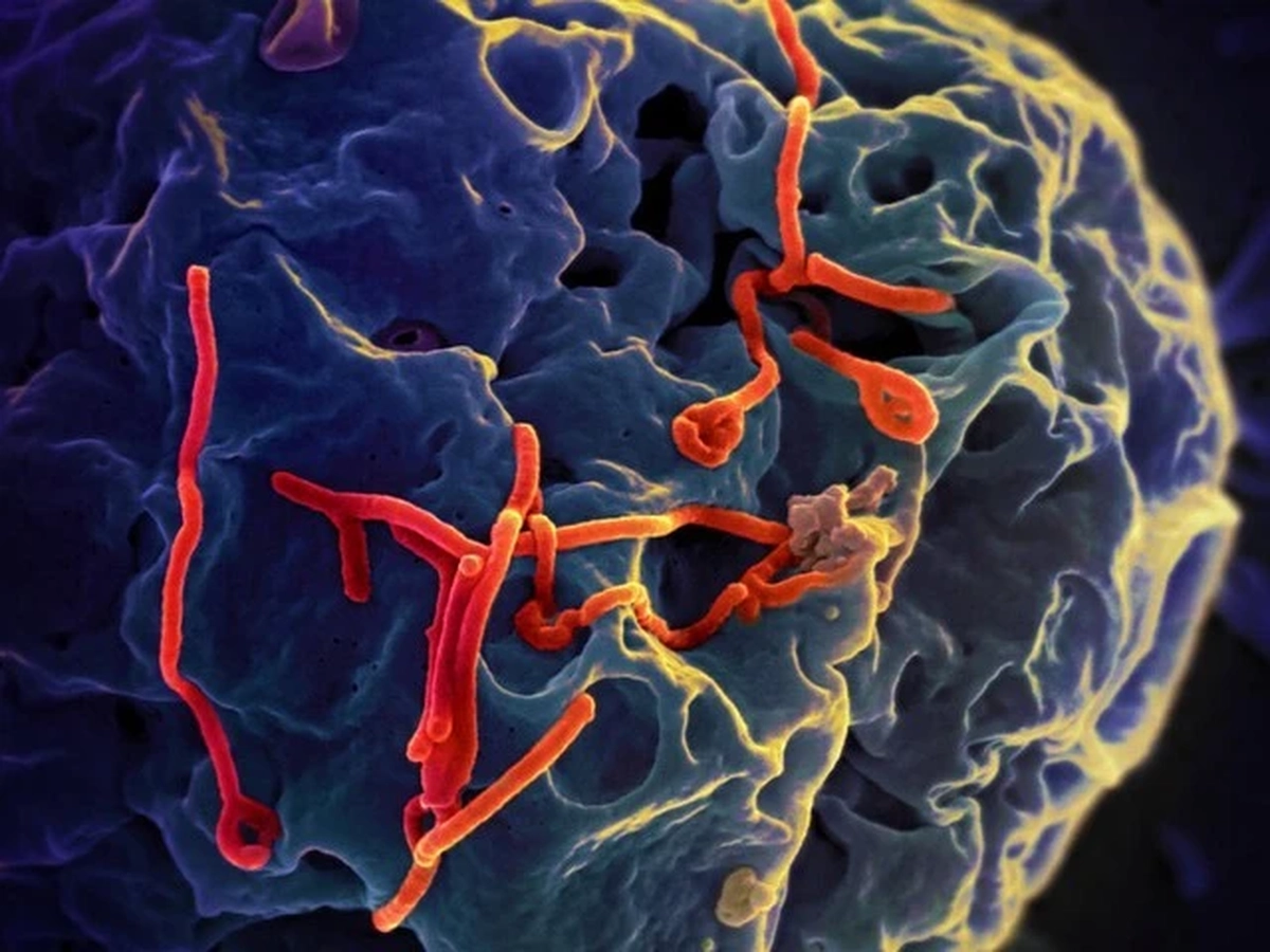 Bộ Y tế đánh giá nguy cơ dịch Ebola tại Việt Nam năm 2026
