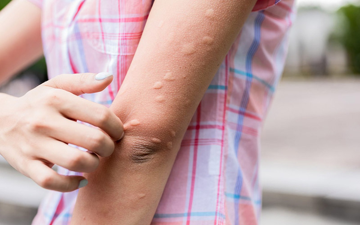 Các phản ứng dị ứng và miễn dịch sau tiêm vắc - xin: Bác sĩ Bệnh viện Bạch Mai chia sẻ