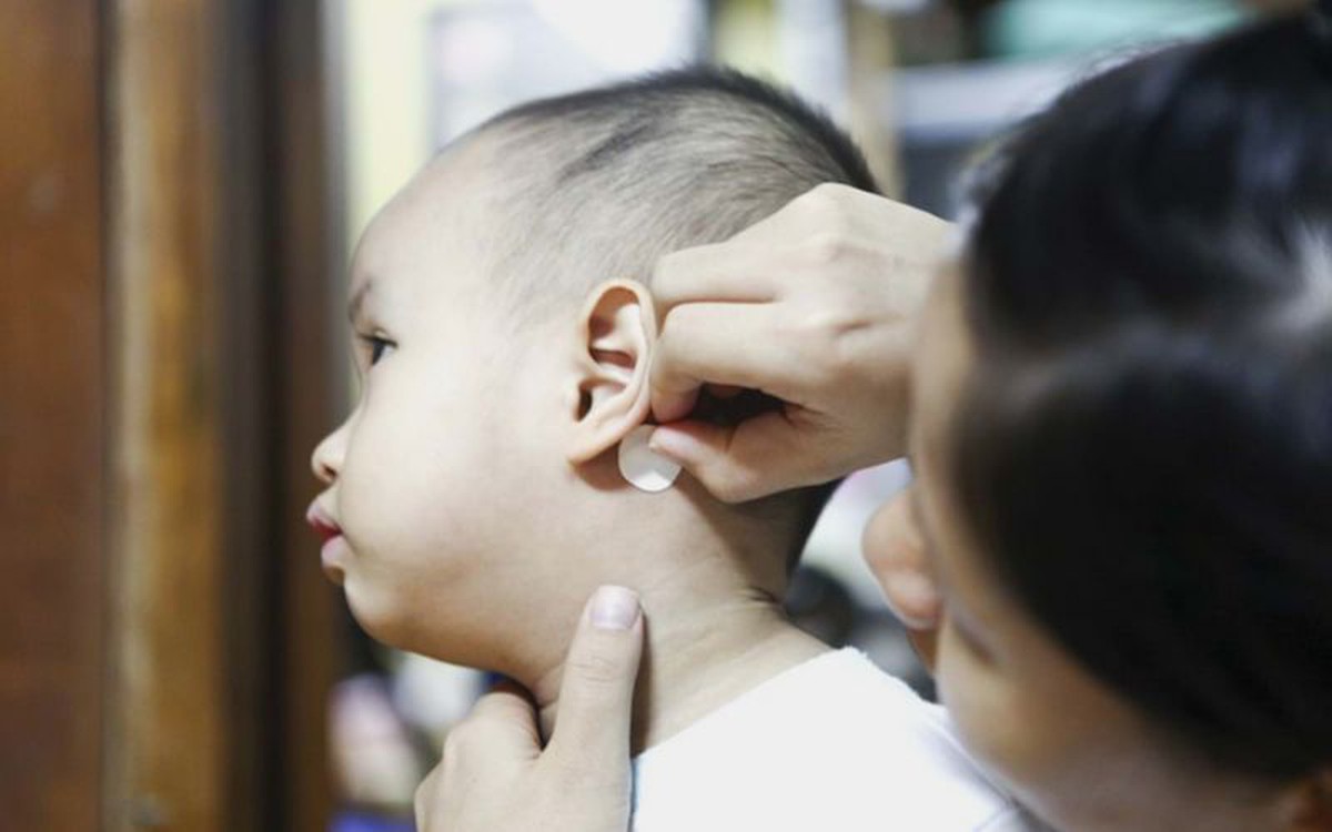 Miếng dán chống say xe - Vật bất ly thân trong túi mỗi gia đình đi du lịch lại đang âm thầm đe dọa trẻ nhỏ